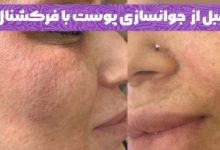  تکنیک‌های جوانسازی در کلینیک دسپینا
