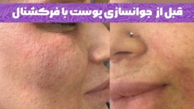  تکنیک‌های جوانسازی در کلینیک دسپینا