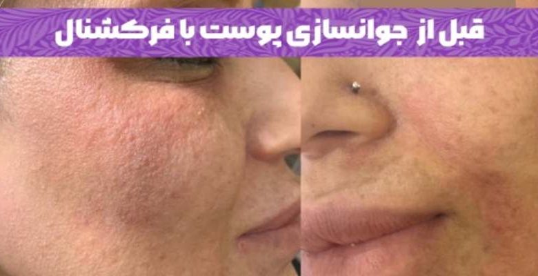  تکنیک‌های جوانسازی در کلینیک دسپینا